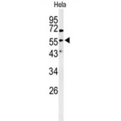 Vimentin (VIM) Antibody