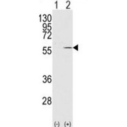 Vimentin (VIM) Antibody