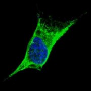 Vimentin (VIM) Antibody