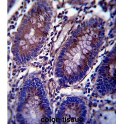 Vimentin (VIM) Antibody