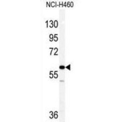 Vimentin (VIM) Antibody