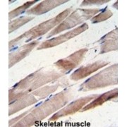 Desmin (DES) Antibody