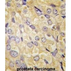 Frizzled Homolog 1 (FZD1) Antibody