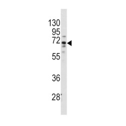 Frizzled Homolog 1 (FZD1) Antibody