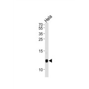 Beta-2-Microglobulin (B2M) Antibody