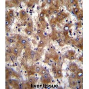 Alpha-(1,3)-Fucosyltransferase 4 (FUT4) Antibody