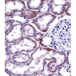 Hepatocyte Nuclear Factor 4 Alpha (HNF4A) Antibody