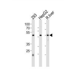 Hepatocyte Nuclear Factor 4 Alpha (HNF4A) Antibody