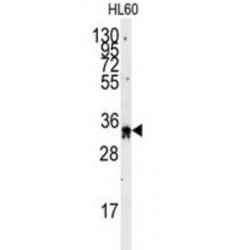 Exosome Component 8 (EXOSC8) Antibody