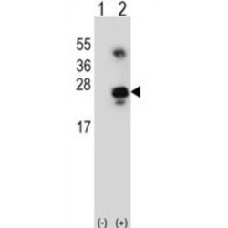 Growth Arrest And DNA Damage-Inducible, Alpha (GADD45A) Antibody