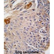 Required For Meiotic Nuclear Division 5 Homolog B (RMND5B) Antibody