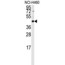 Required For Meiotic Nuclear Division 5 Homolog B (RMND5B) Antibody