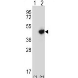 Required For Meiotic Nuclear Division 5 Homolog B (RMND5B) Antibody