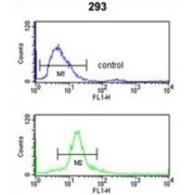 Lupus La Protein (SSB) Antibody