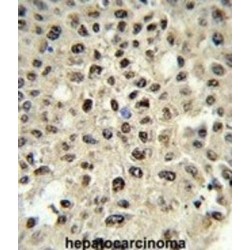 Lupus La Protein (SSB) Antibody