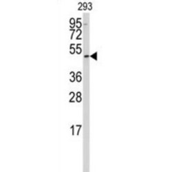 Lupus La Protein (SSB) Antibody