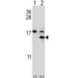 S100 Calcium Binding Protein A11 (S100A11) Antibody