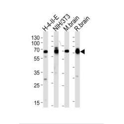 Stress-Induced-Phosphoprotein 1 (STIP1) Antibody