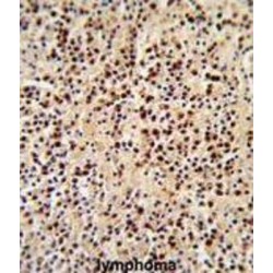 Proto-Oncogene Tyrosine-Protein Kinase LCK (LCK) Antibody