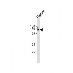 Proto-Oncogene Tyrosine-Protein Kinase LCK (LCK) Antibody