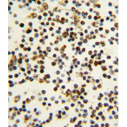 Nucleophosmin (NPM1) Antibody
