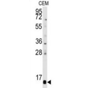 Prefoldin Subunit 6 (PFDN6) Antibody