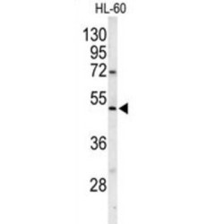 Polymerase DNA Directed Gamma 2 (POLG2) Antibody