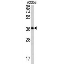 RNA Polymerase I Subunit C (POLR1C) Antibody