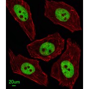 Flap Structure Specific Endonuclease 1 (FEN1) Antibody