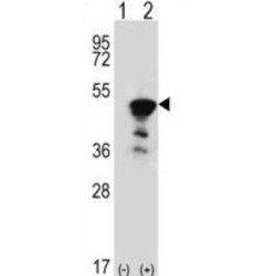 Flap Structure Specific Endonuclease 1 (FEN1) Antibody