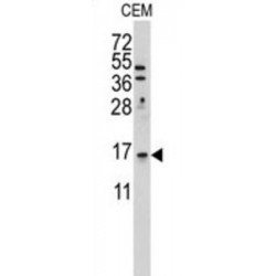 LSM1 Homolog, mRNA Degradation Associated (LSM1) Antibody