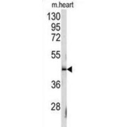 Signaling Lymphocytic Activation Molecule Family Member 1 / CD150 (SLAMF1) Antibody