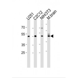 Alpha-Enolase (ENO1) Antibody