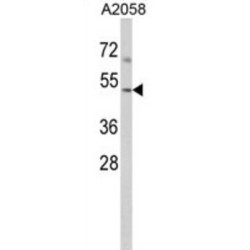 Actin Related Protein 3 (ACTR3) Antibody