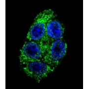 Dimethylarginine Dimethylaminohydrolase 1 (DDAH1) Antibody