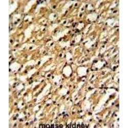 Dimethylarginine Dimethylaminohydrolase 1 (DDAH1) Antibody