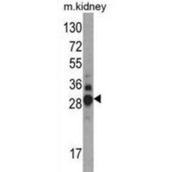 Dimethylarginine Dimethylaminohydrolase 1 (DDAH1) Antibody