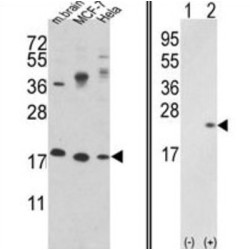 Cofilin 1 (CFL1) Antibody