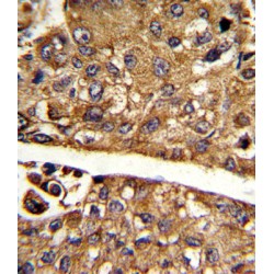 Malate Dehydrogenase 1 (MDH1) Antibody