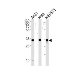 Malate Dehydrogenase 2 (MDH2) Antibody