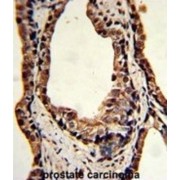 Triosephosphate Isomerase (TPI1) Antibody