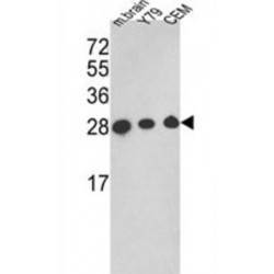 Triosephosphate Isomerase (TPI1) Antibody