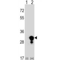 Triosephosphate Isomerase (TPI1) Antibody