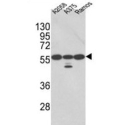 Protein Disulfide Isomerase A3 (PDIA3) Antibody