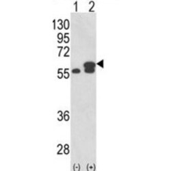 Protein Disulfide Isomerase A3 (PDIA3) Antibody