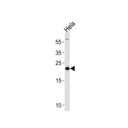 Peroxiredoxin 2 (PRDX2) Antibody