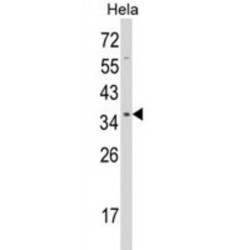 Serine-Threonine Kinase Receptor-Associated Protein (STRAP) Antibody