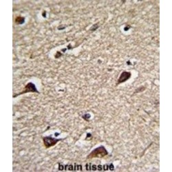 6-Phosphogluconolactonase (PGLS) Antibody