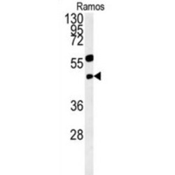 D-3-Phosphoglycerate Dehydrogenase (PHGDH) Antibody