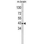 Aspartate Aminotransferase, Cytoplasmic (GOT1) Antibody